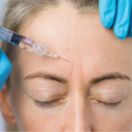 Botox Injections