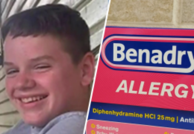 Benadryl challenge