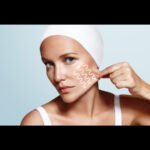 Skin Tightening Home Remedies)