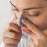 Blackhead Remove Remedies