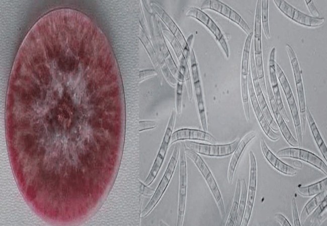 Fusarium graminearum