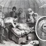 First Plastic Surgery | Top Marathi Headlines